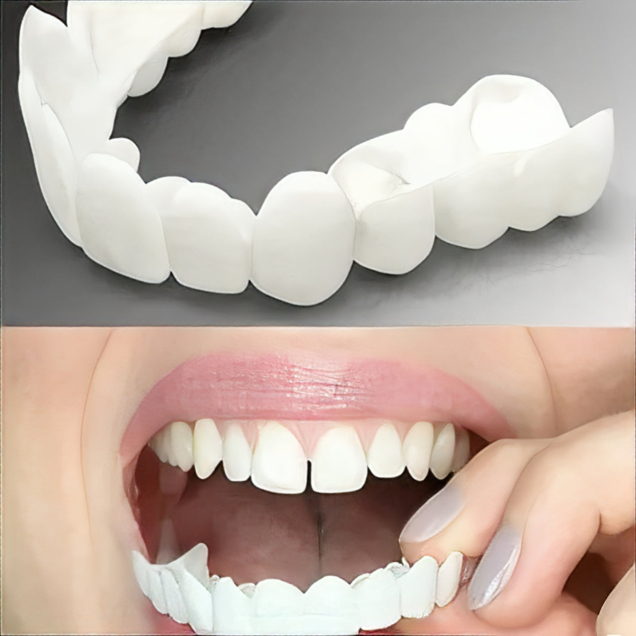 [Hometech] Adjustable Cosmetic Smile Veneers, Upper & Lower Set