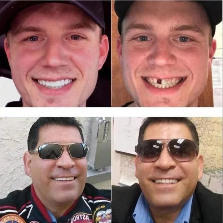 [Hometech] Adjustable Cosmetic Smile Veneers, Upper & Lower Set