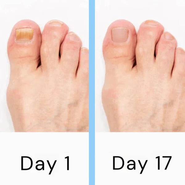 [Hometech] Electric Nail Care Device – Portable Rechargeable Grooming Tool