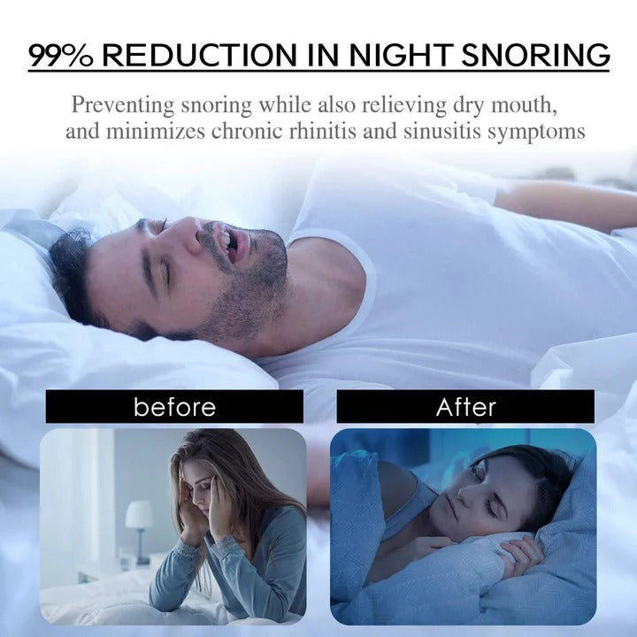 [Hometech] Sleep Mouth Tape for Nasal Breathing Support