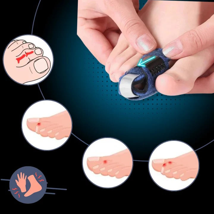 [Hometech] Toe Positioning Support with Breathable Design