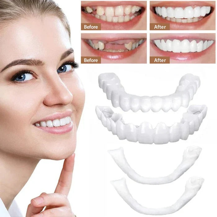 [Hometech] Clip On Cosmetic Veneers and Temporary Tooth Covers