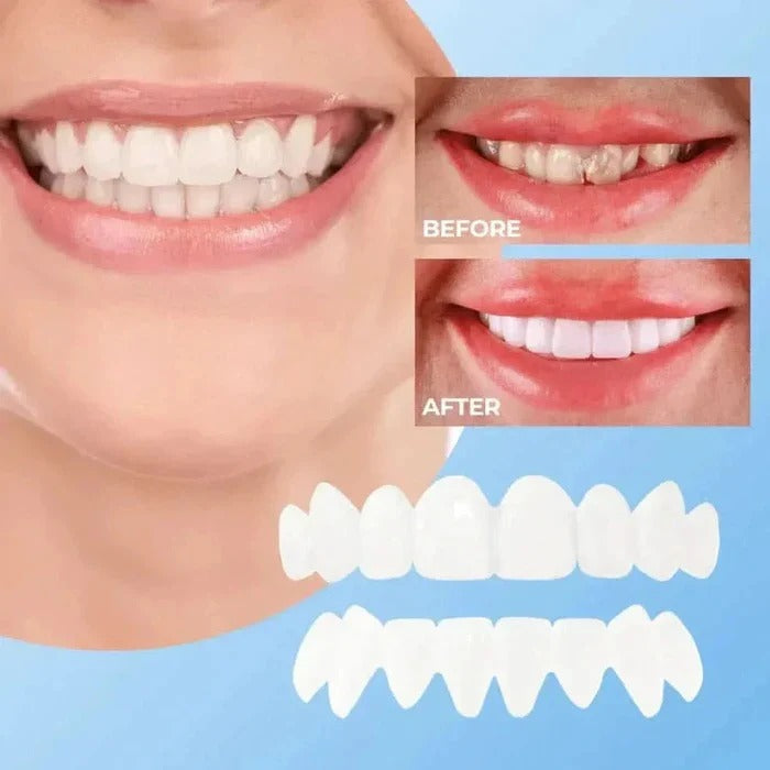 [Hometech] Clip On Cosmetic Veneers and Temporary Tooth Covers