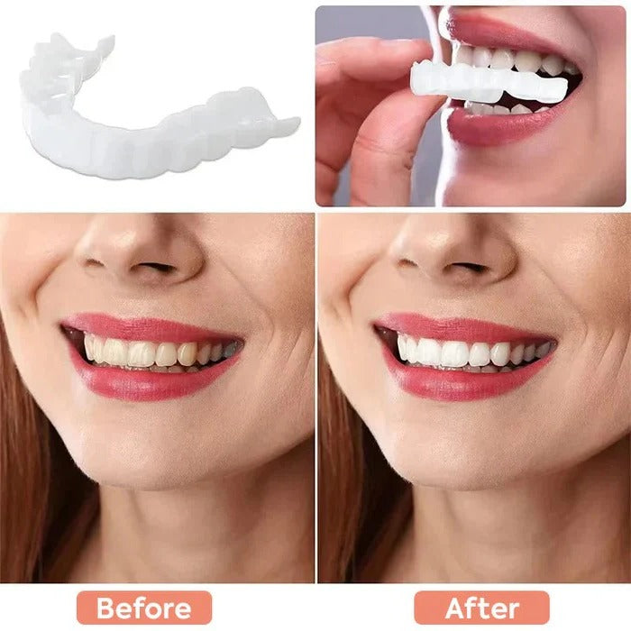 [Hometech] Clip On Cosmetic Veneers and Temporary Tooth Covers