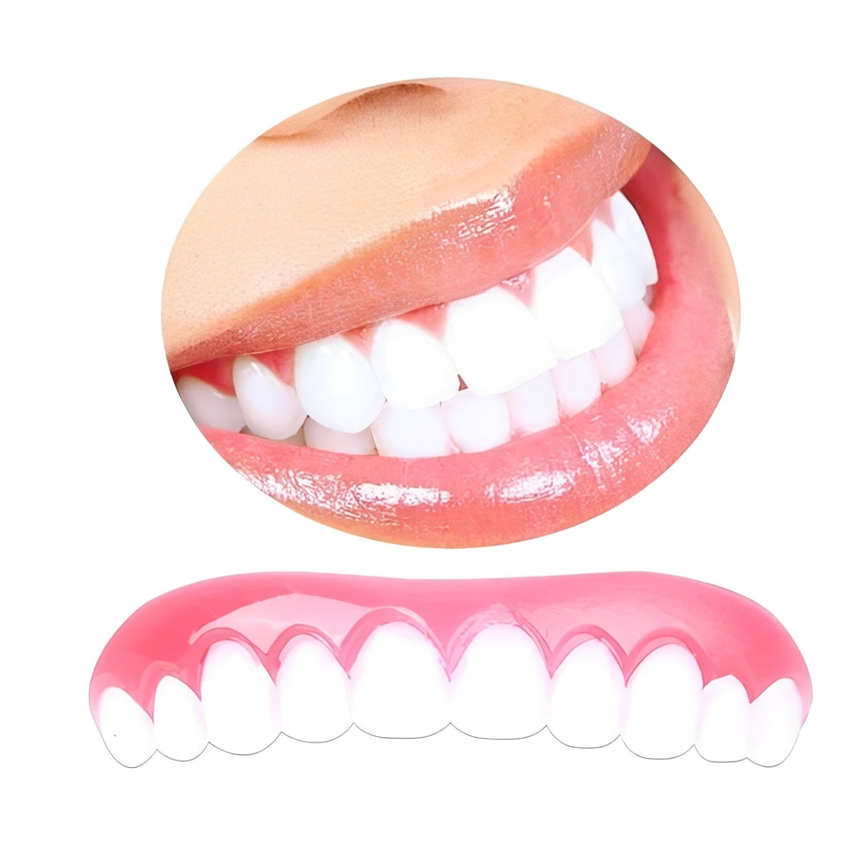 [Hometech] Reusable Artificial Tooth Veneer for Short Term Cosmetic Wear