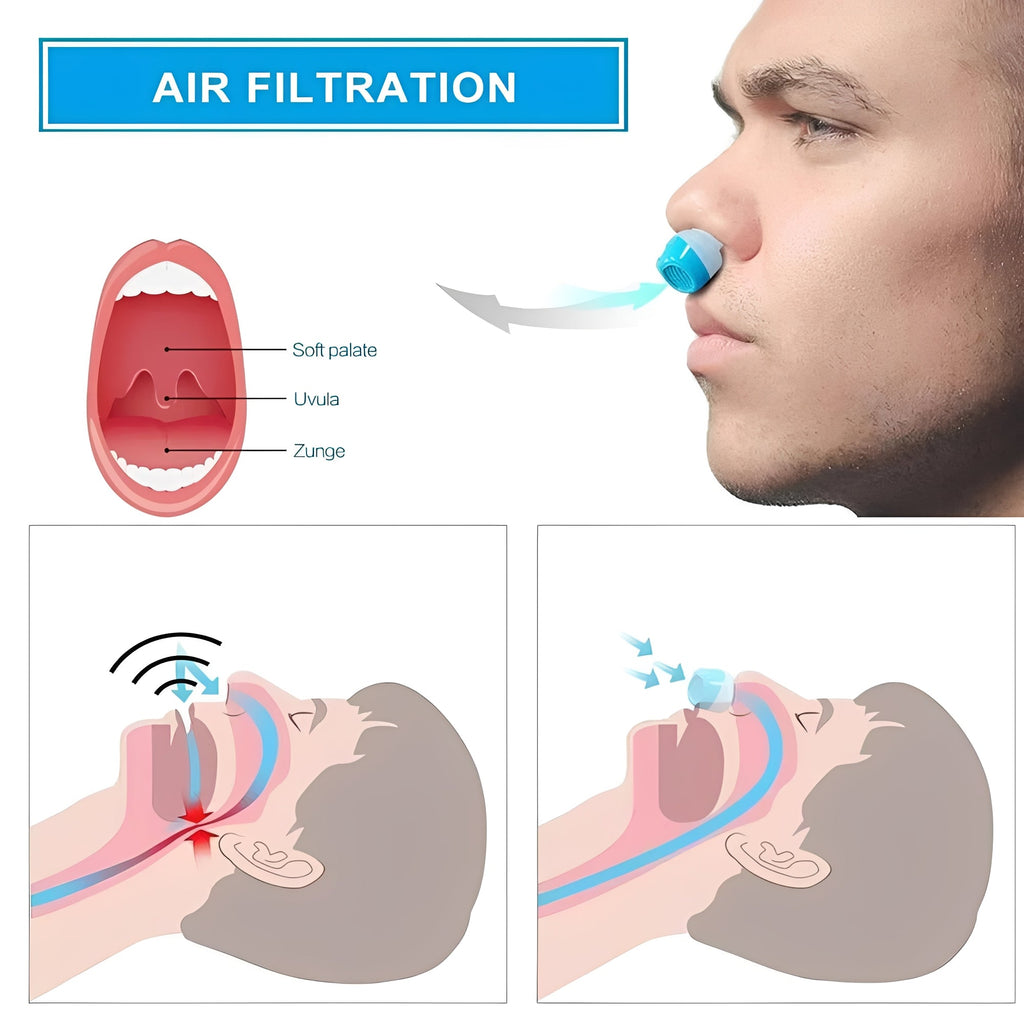 [Hometech] Cordless Nasal Sleep Aid Device, Compact Snoring Support Insert