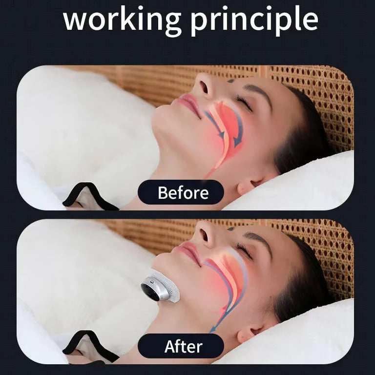 [Hometech] Snoring Support Device with Automatic Stimulation Adjustment