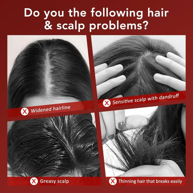 [Hometech] Scalp Massage Brush with Red Light for Hair Support