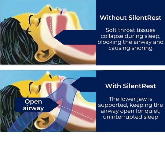 [Hometech] Chin Strap for Snoring and Sleep Support