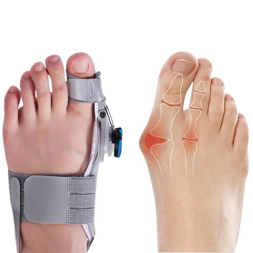 [Hometech] Adjustable Toe Spacer for Foot Alignment Support