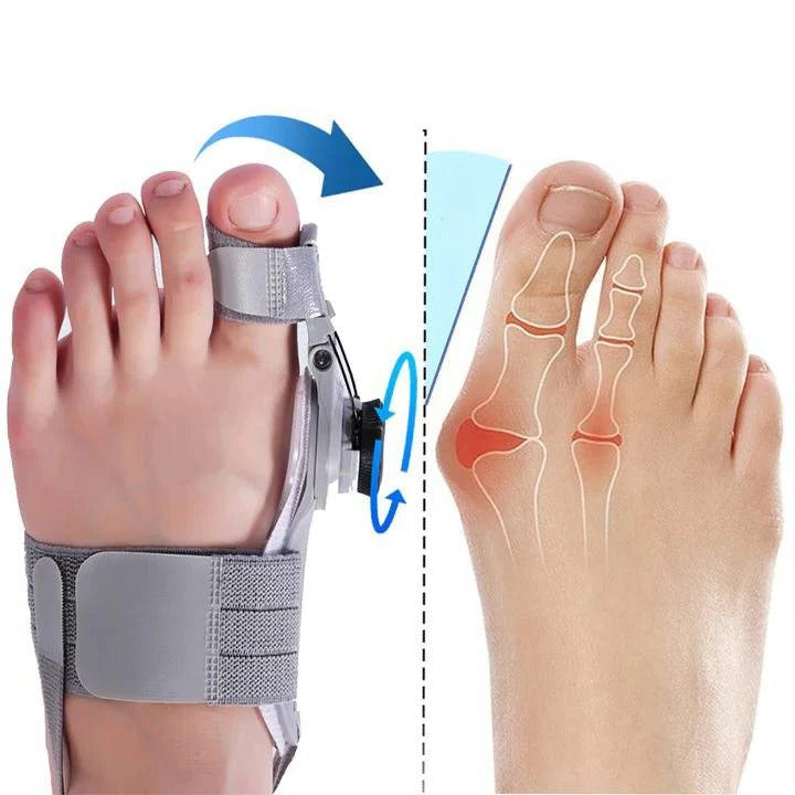 [Hometech] Adjustable Toe Spacer for Foot Alignment Support